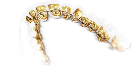 Lingualtechnik Lachgut Bild